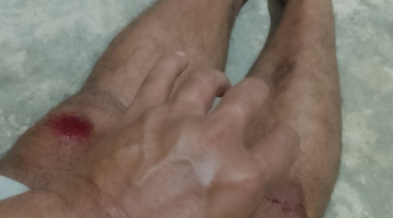 Tidak terima DPOnya Diterbitkan dalam pemberitaan Media Targetbuser86.com Pimpinan Redaksi Media Khairunan Domo di Serang Oleh dua orang pria berasal dari Desa Ganting Damai-Kec Salo